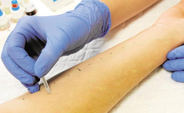 Pruebas para identificar alergias